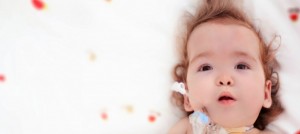 Infant with Down syndrome lying on a white blanket with red and yellow dots. Infant has a feeding tube.