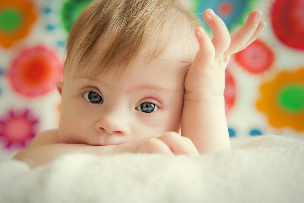 little baby girl with Down Syndrome on soft cream colored blanket with multicolored background